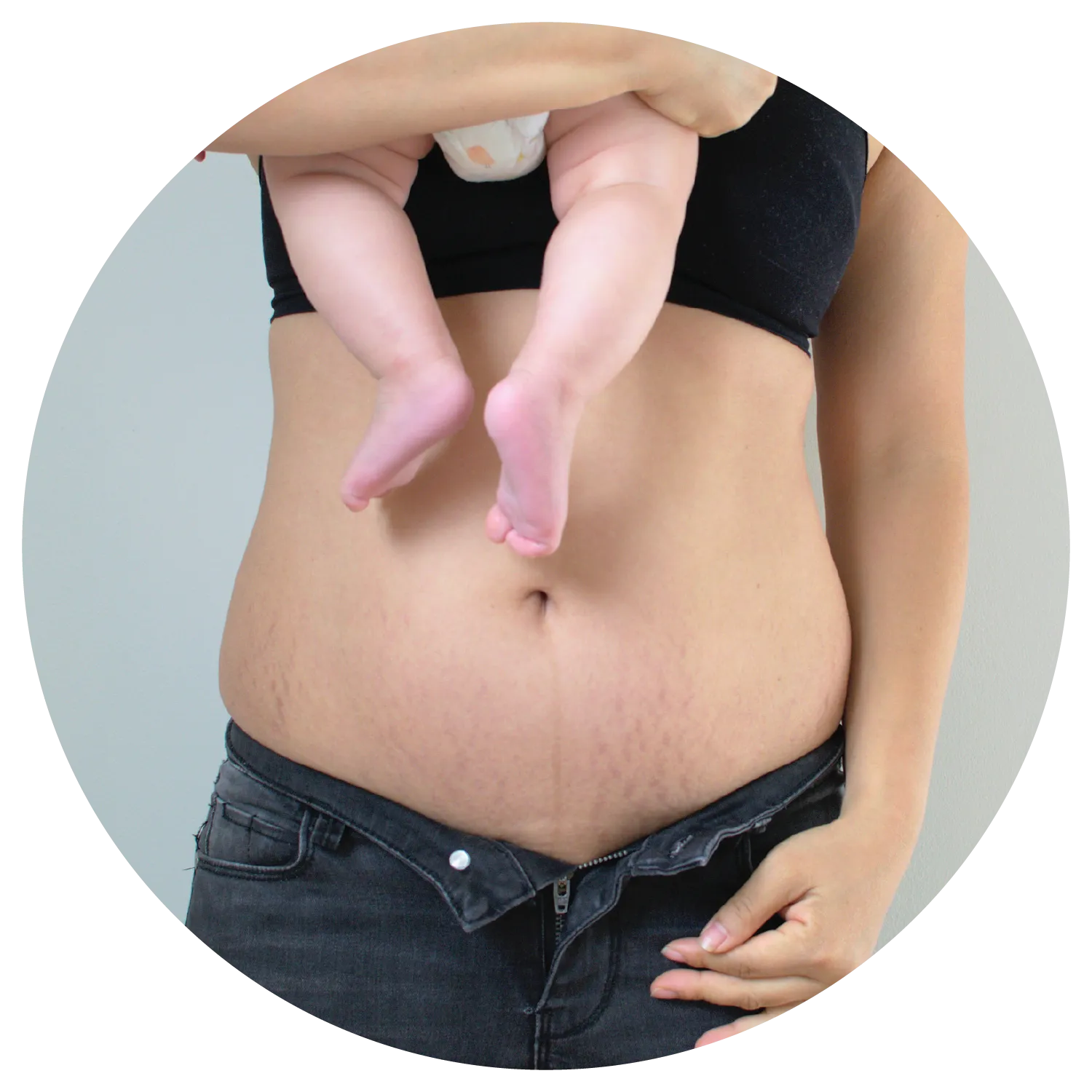 Postpartum treatment results at Toronto medical spa - The Chain Reaction of Symptoms
